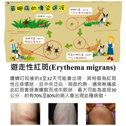 台出現今年首例境外移入萊姆病確定個案　法國男返鄉遭蜱蟲叮咬