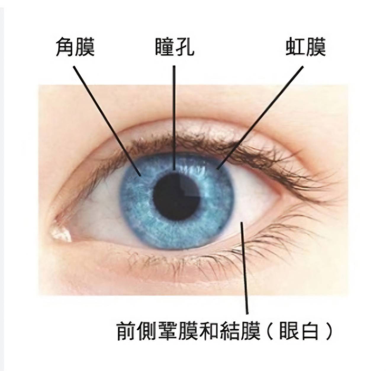【專欄】一次險些失明的經驗­­：1972年全台角膜炎大流行